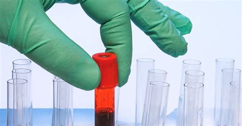 blood analyzer laboratory mouse catecholamines|Blood sampling methodology is crucial for precise  .